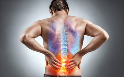 What is Sciatica?